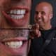 Slider image (10) Dentaray Clinic: luxury Dental Clinic in Istanbul